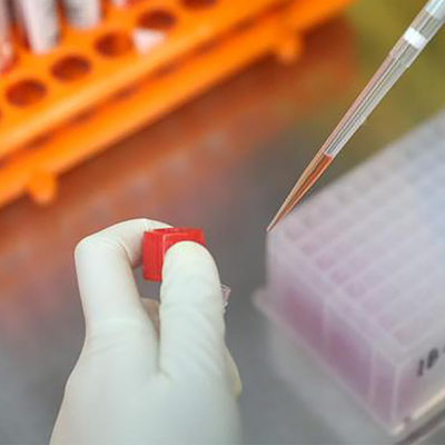 کیت تست IgM IgG Virus Virus Monkeypox Colloidal Gold CE ثبت شده است